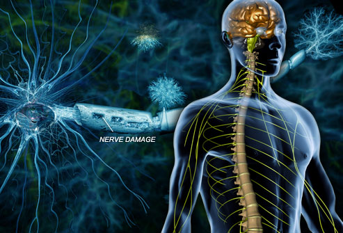 Multiple Sclerosis: What you Need to Know!